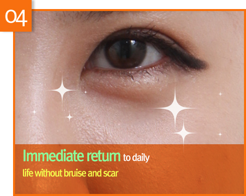 lower eyebag reposition