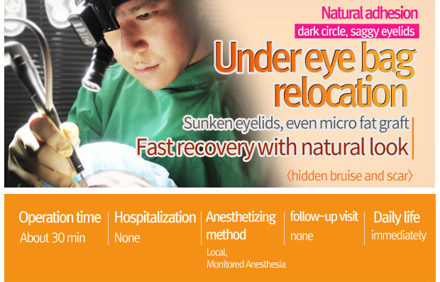 lower eyebag reposition