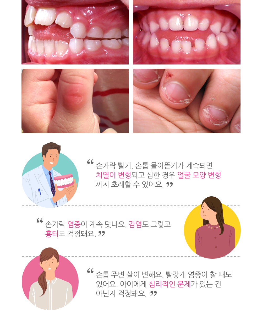 치열변형과 손 흉터 이미지