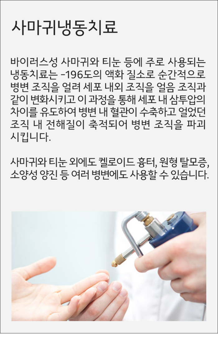 인덕원역 피부과 사마귀 종류와 치료 - 냉동/레이저 치료 3