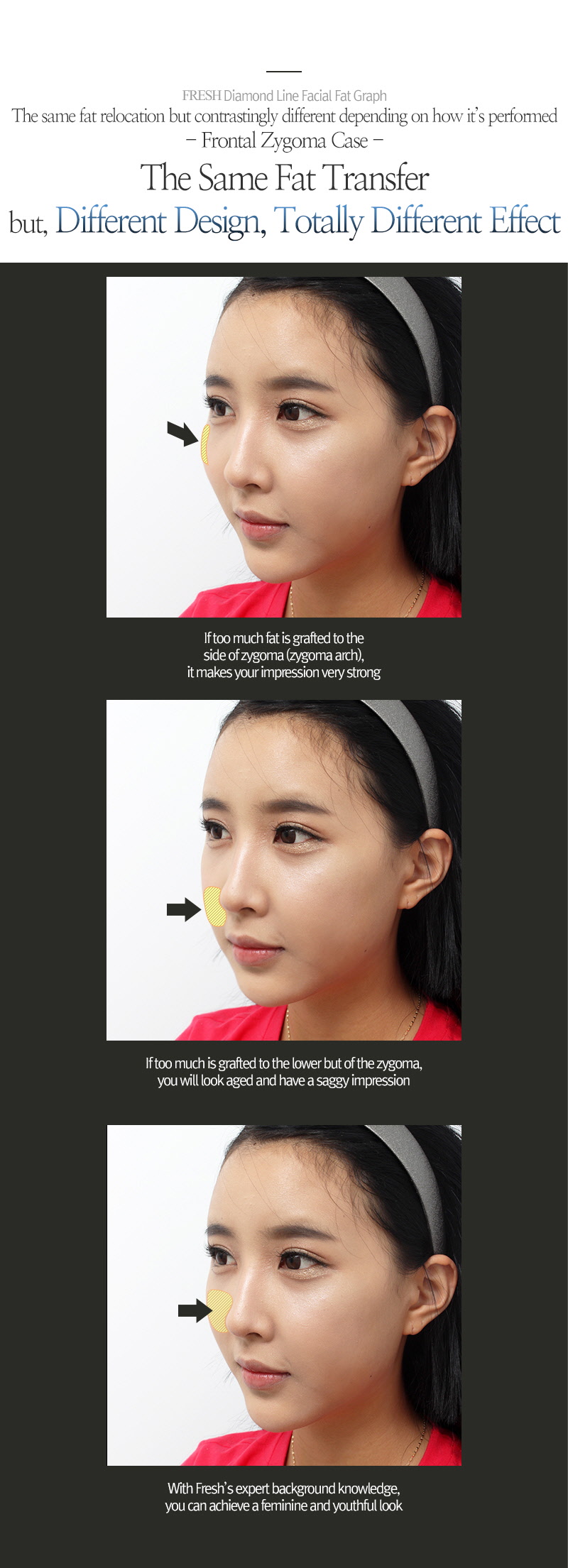 facial liposuction