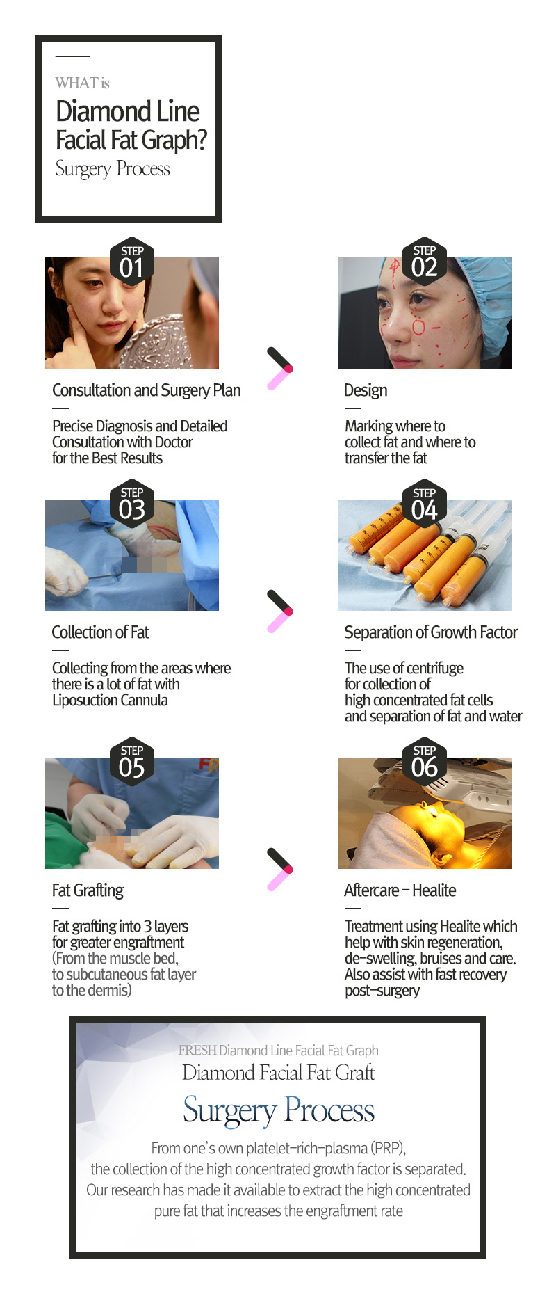 facial liposuction