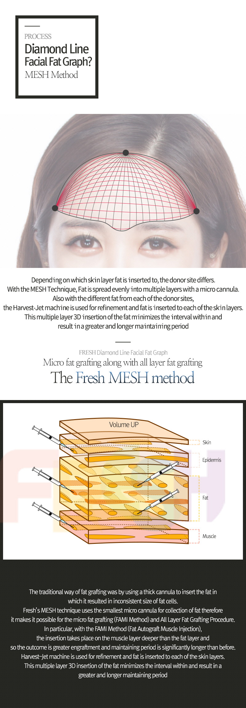 facial liposuction