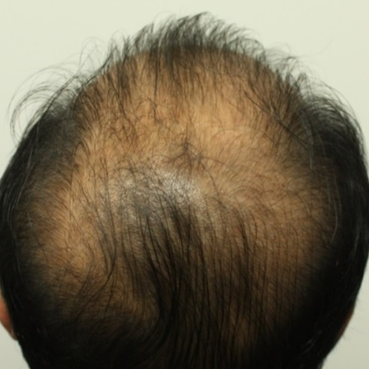 ProCell Therapeutics, Inc