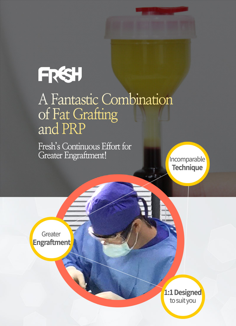 facial fat graft