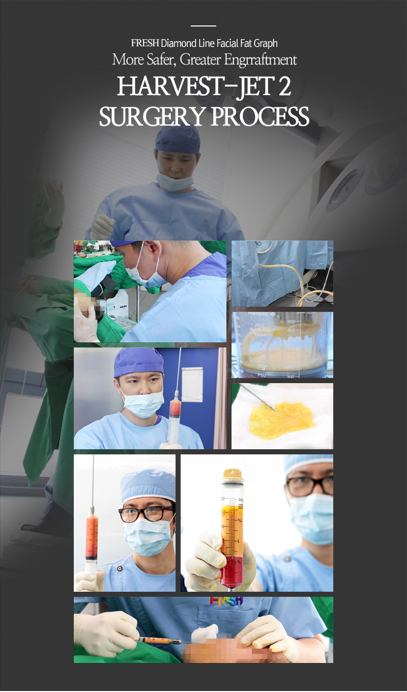 facial liposuction