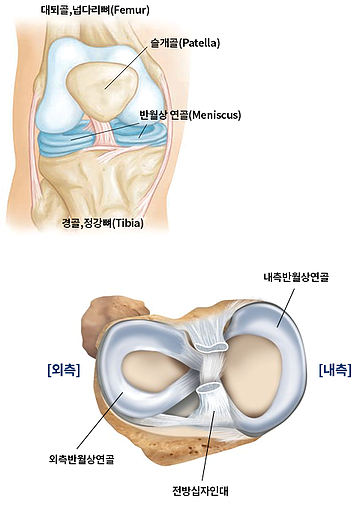 무릎통증