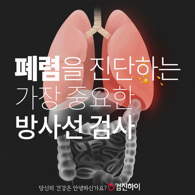 폐렴을 진단하는 가장 중요한 방사선 검사 : 건강검진정보