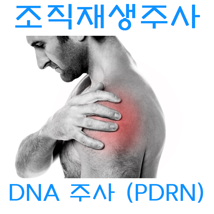 DNA주사 치료 알아보기