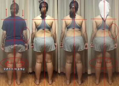 라운드 숄더 교정은 제주 체형교정 라비앙 바디부터