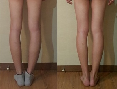 하체 Before / After