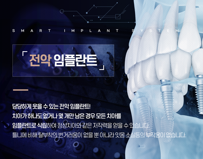 임플란트 가격 의문점 대구스마트치과 해결