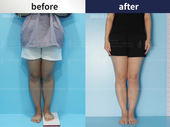 ความผิดรูปหลังอุบัติเหตุ