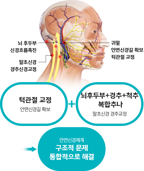 안면마비한의원추천 턱관절신경이상 후유증케어