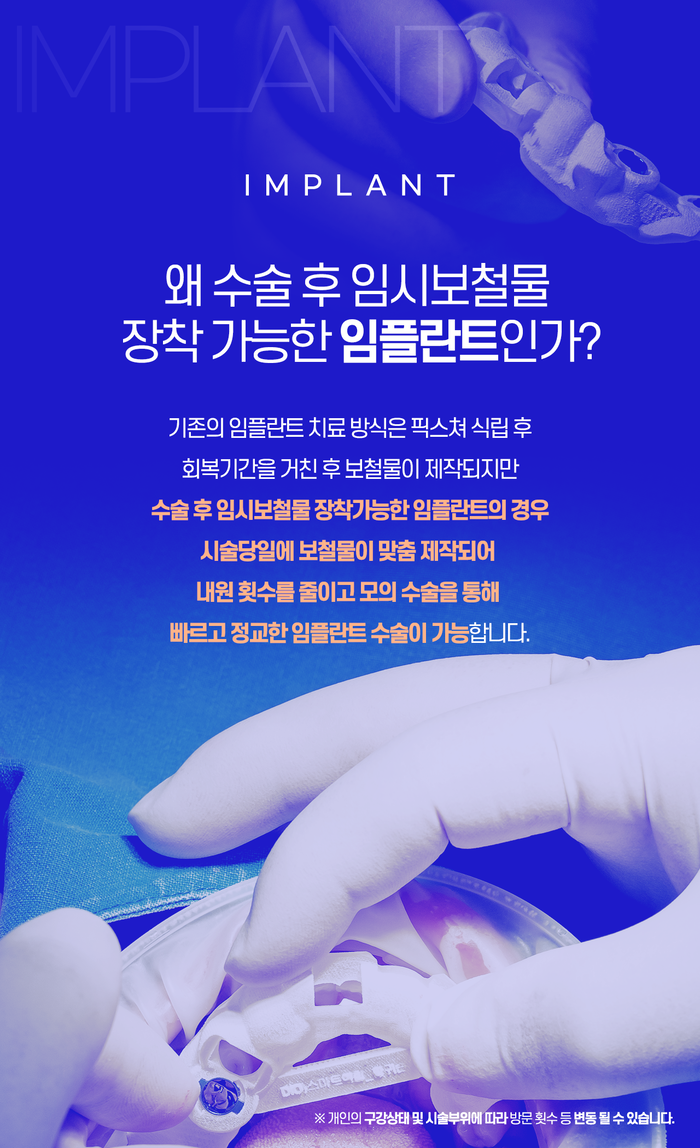 대구임플란트잘하는곳 정교한 식립으로 1