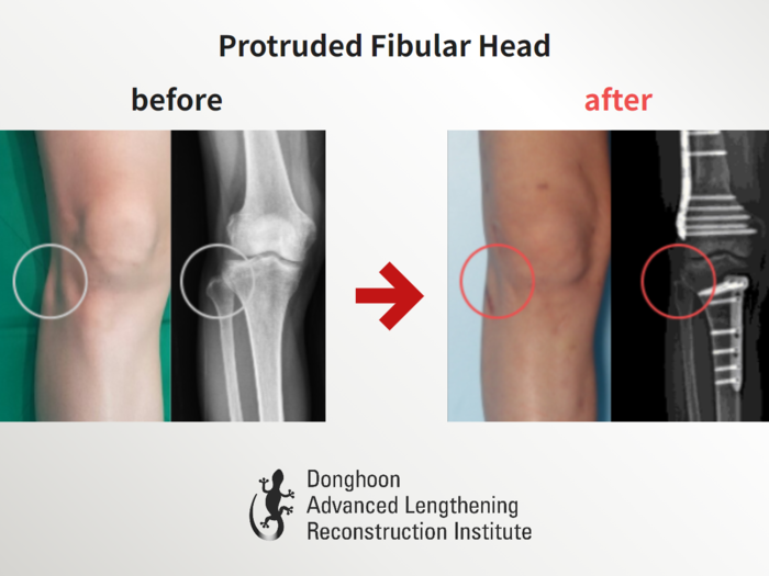 Congenital & paediatric conditions before and after radiograph example 2