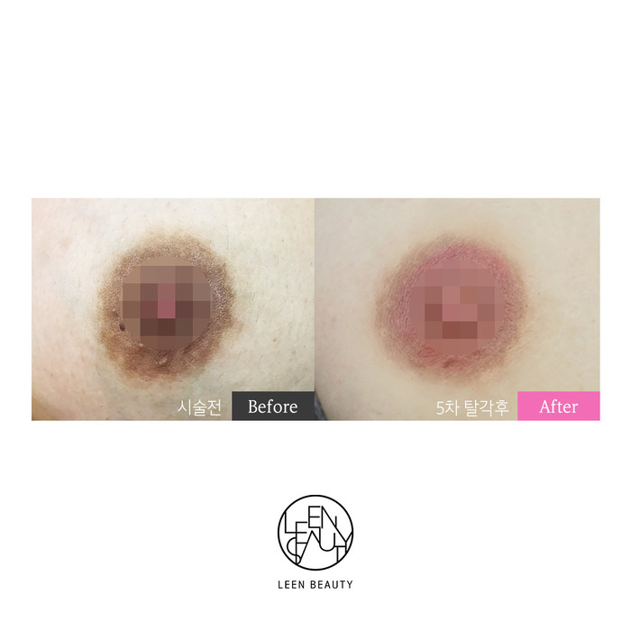 (피탕이린뷰티) 유륜/입술 반영구 1일 코스