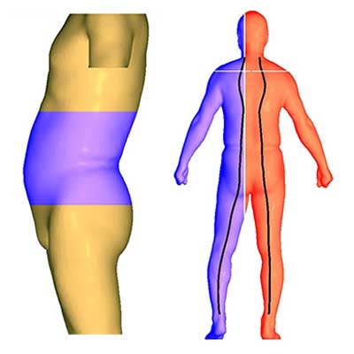3D Body Scanner. Obesity & Posture Management S/W