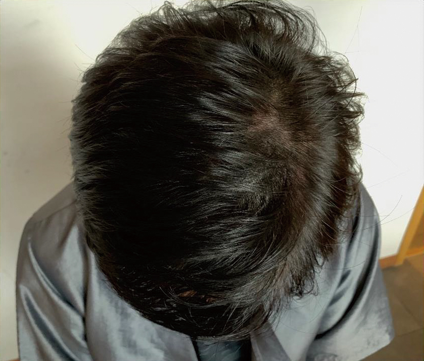 After