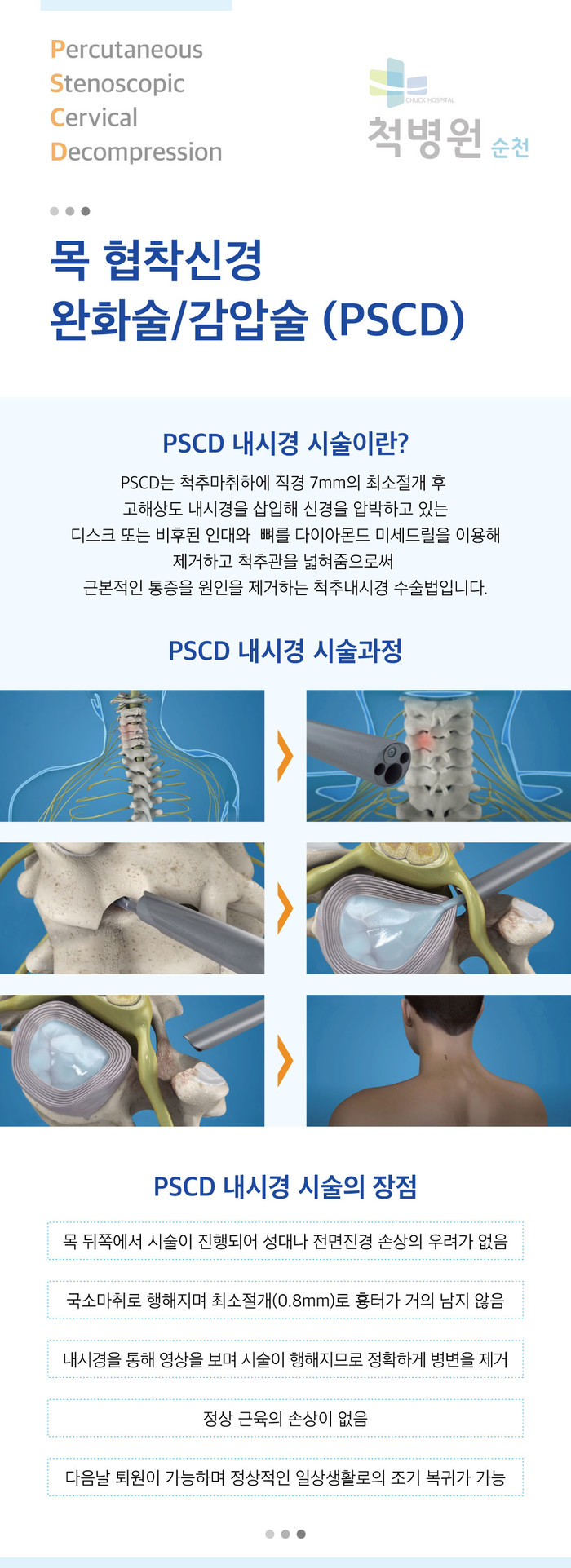 허리디스크