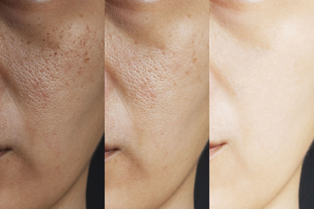 Skin Balance