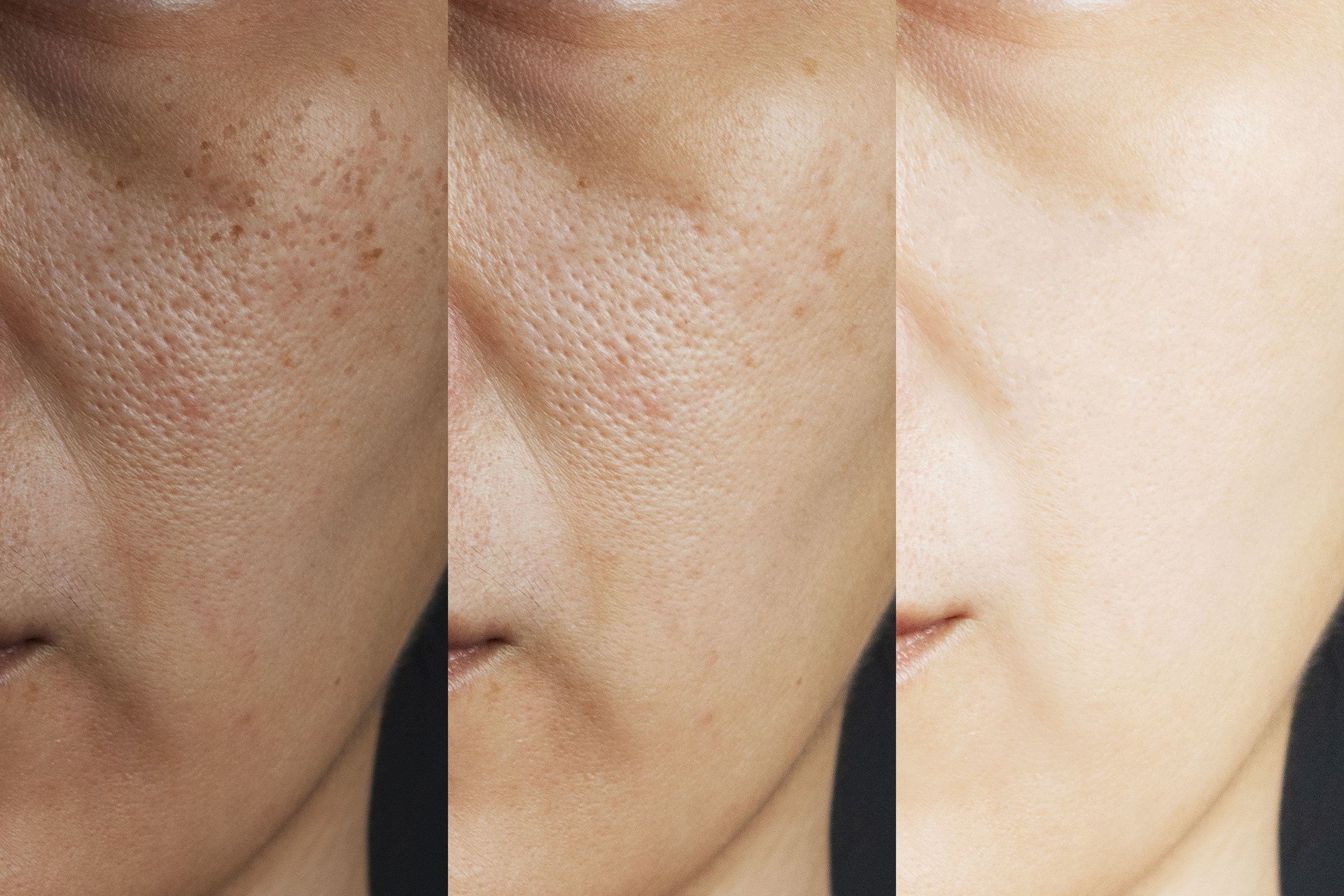Skin Balance