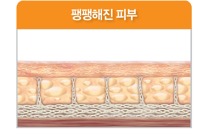 팽팽해진 피부