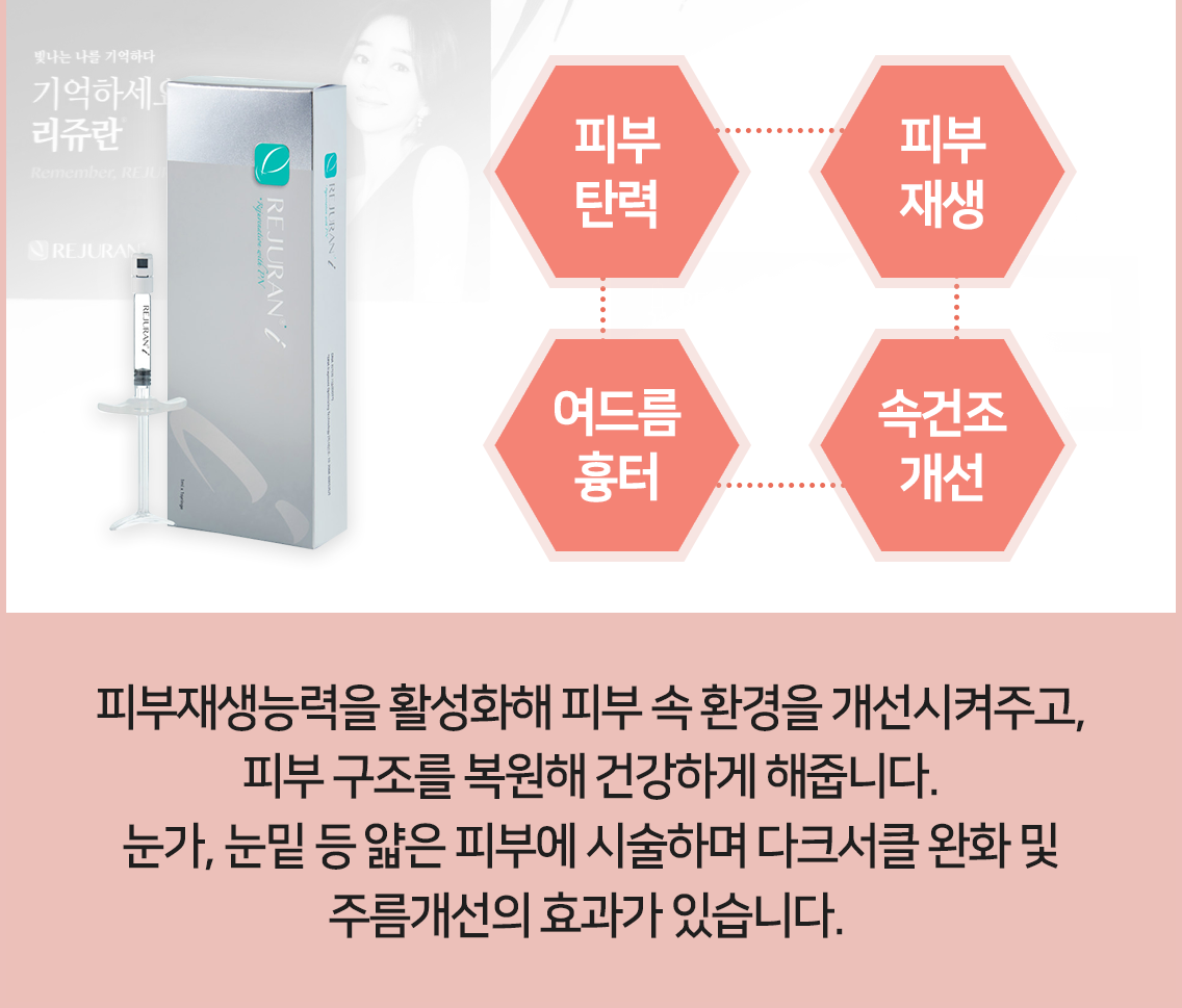 리쥬란아이