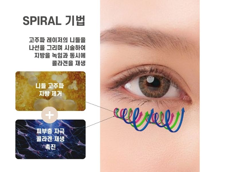 SPIRAL