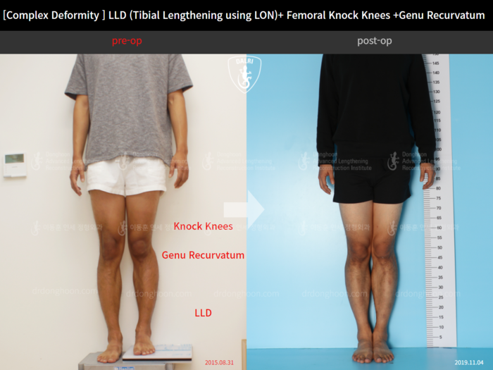 ยืดทั้งต้นขาและหน้าแข้ง