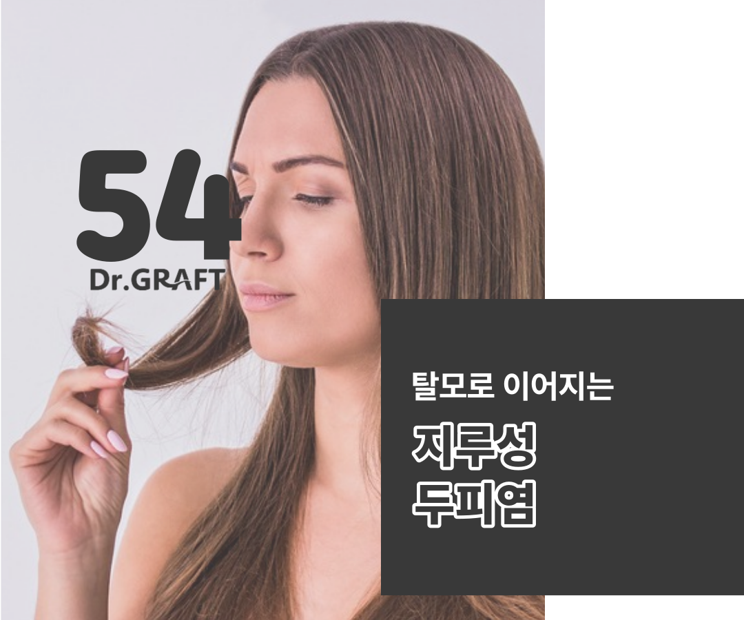 청소년 탈모, 두피 지루성 피부염 샴푸 초기에 해요! 6