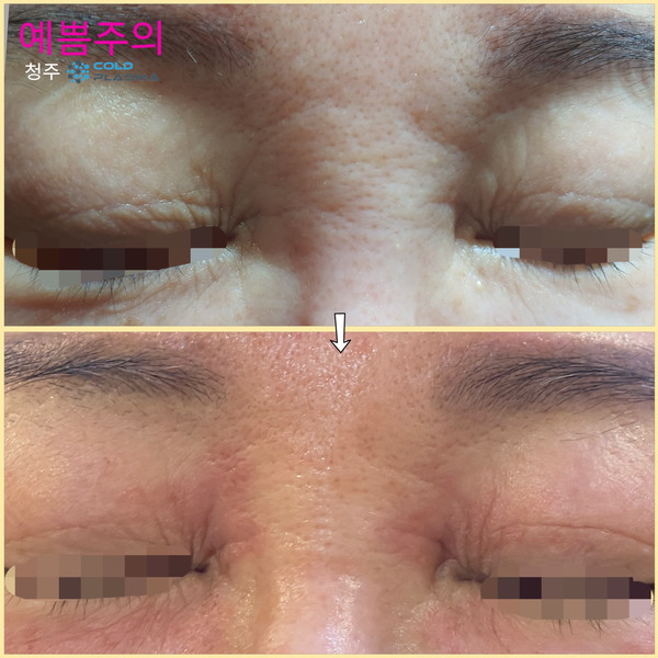 [청주] 예쁨주의