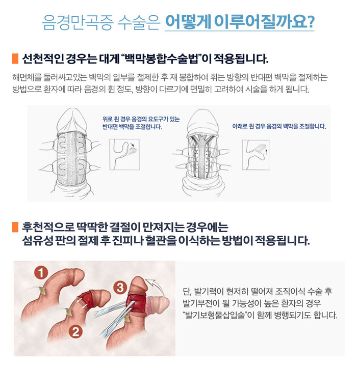 교정이 필요한 여성형 유방