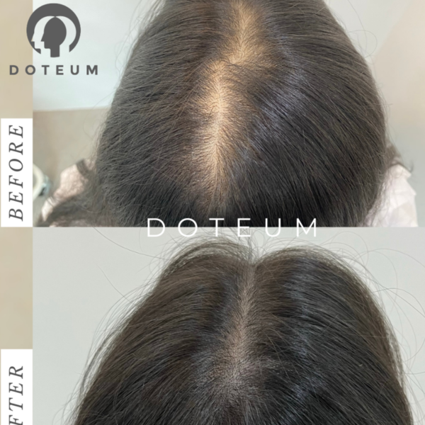 [경기 의정부] 돋음스칼프