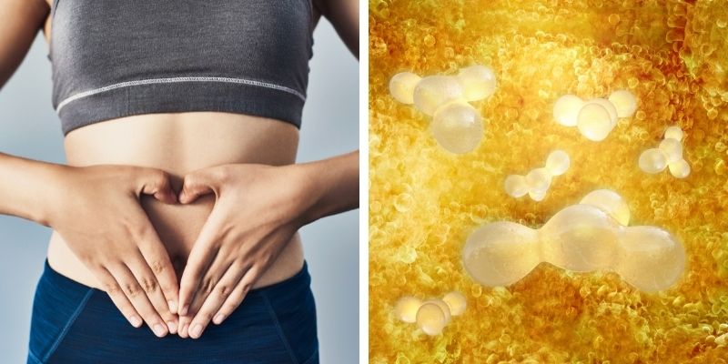 FAT CELLS