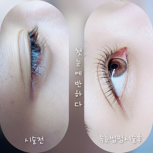 [경기 여주] 첫눈에 반하다