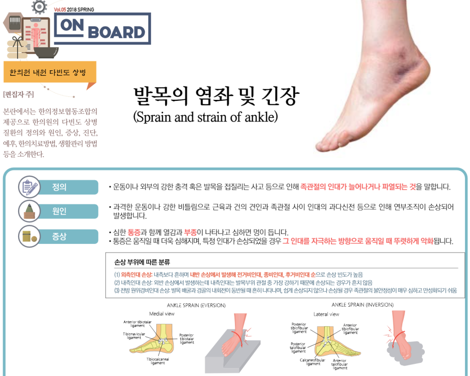 발목의 염좌 및 긴장 : 더베스트한의원