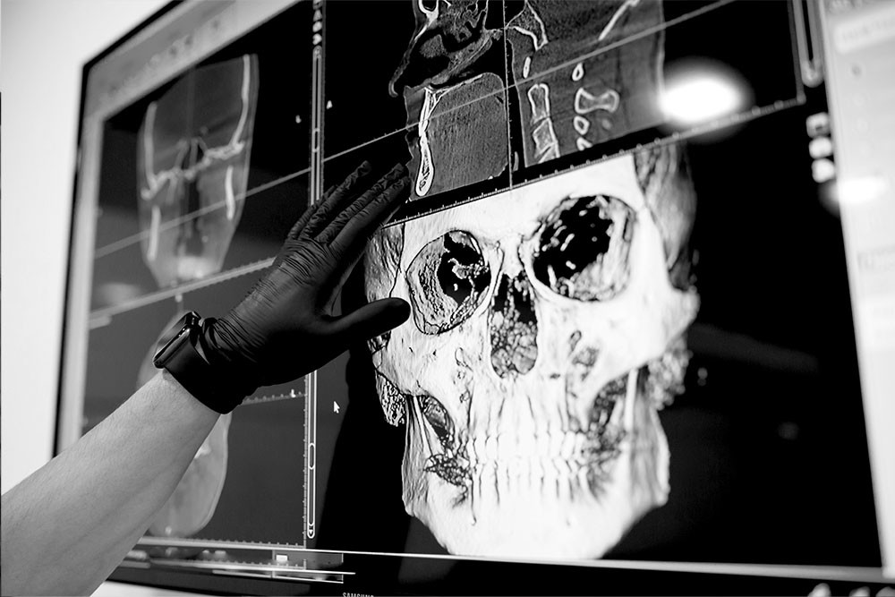 남천동-광안리치과-유엘치과-임플란트-CT검사