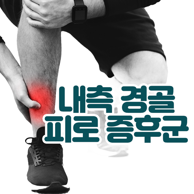 내측 경골 피로 증후군 : 레그웰의원 질환정보 내측 경골 피로 증후군 : 레그웰의원 질환정보