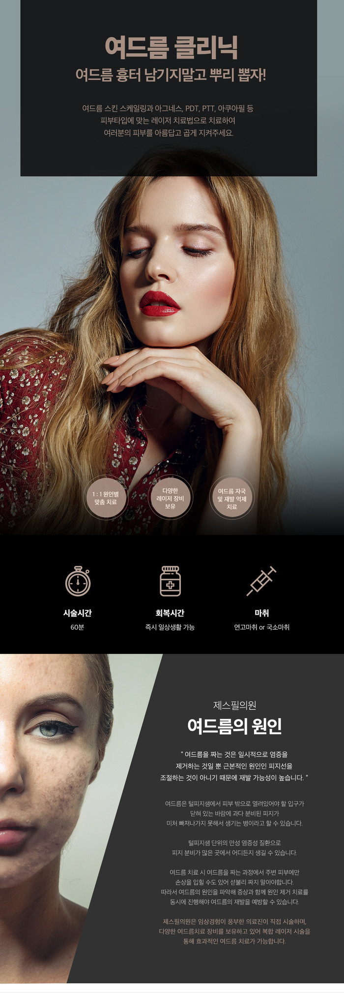 울산 등드름 흉터 제거 피부과, 3