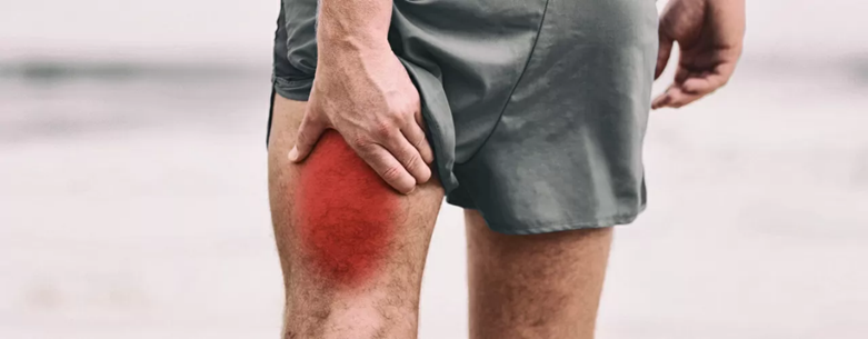 햄스트링 손상 (hamstring strain injury) : research | 1Physio
