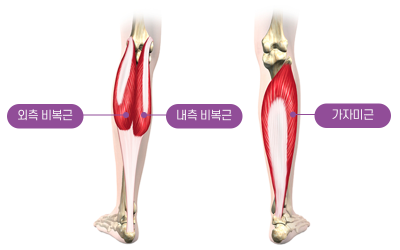 종아리보톡스 시술부위
