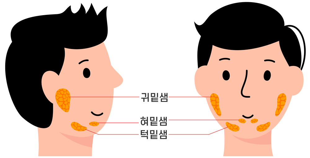 침샘비대증