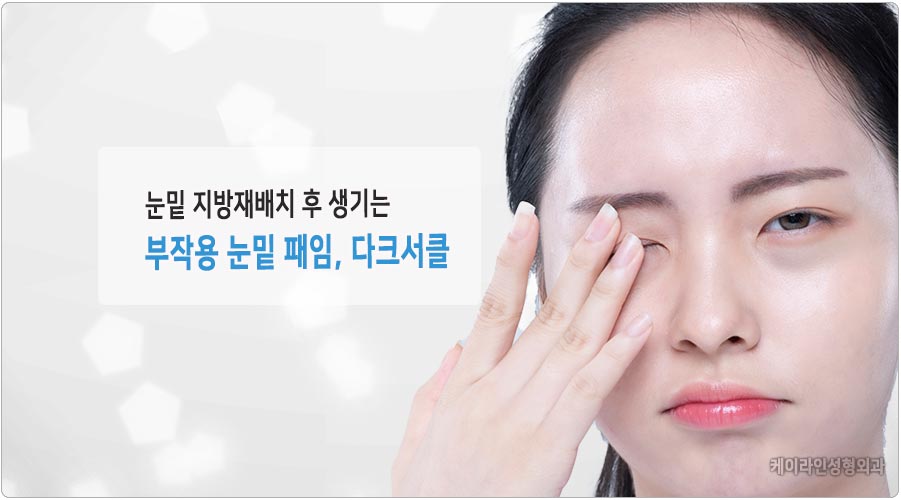 눈밑 지방재배치 후 부작용은 없을까요? 눈밑지방재배치 체크사항 : 케이라인 자주묻는질문