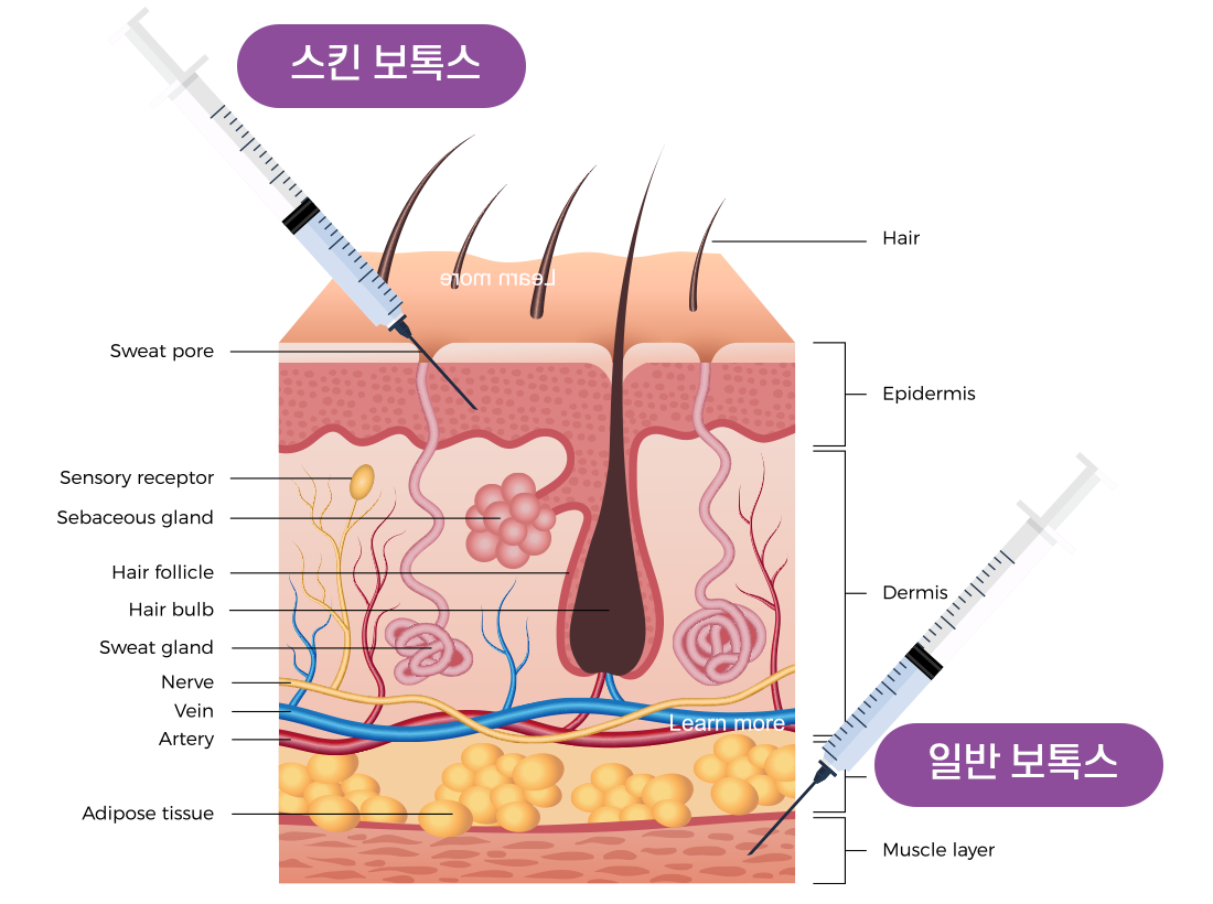 스킨보톡스 차이