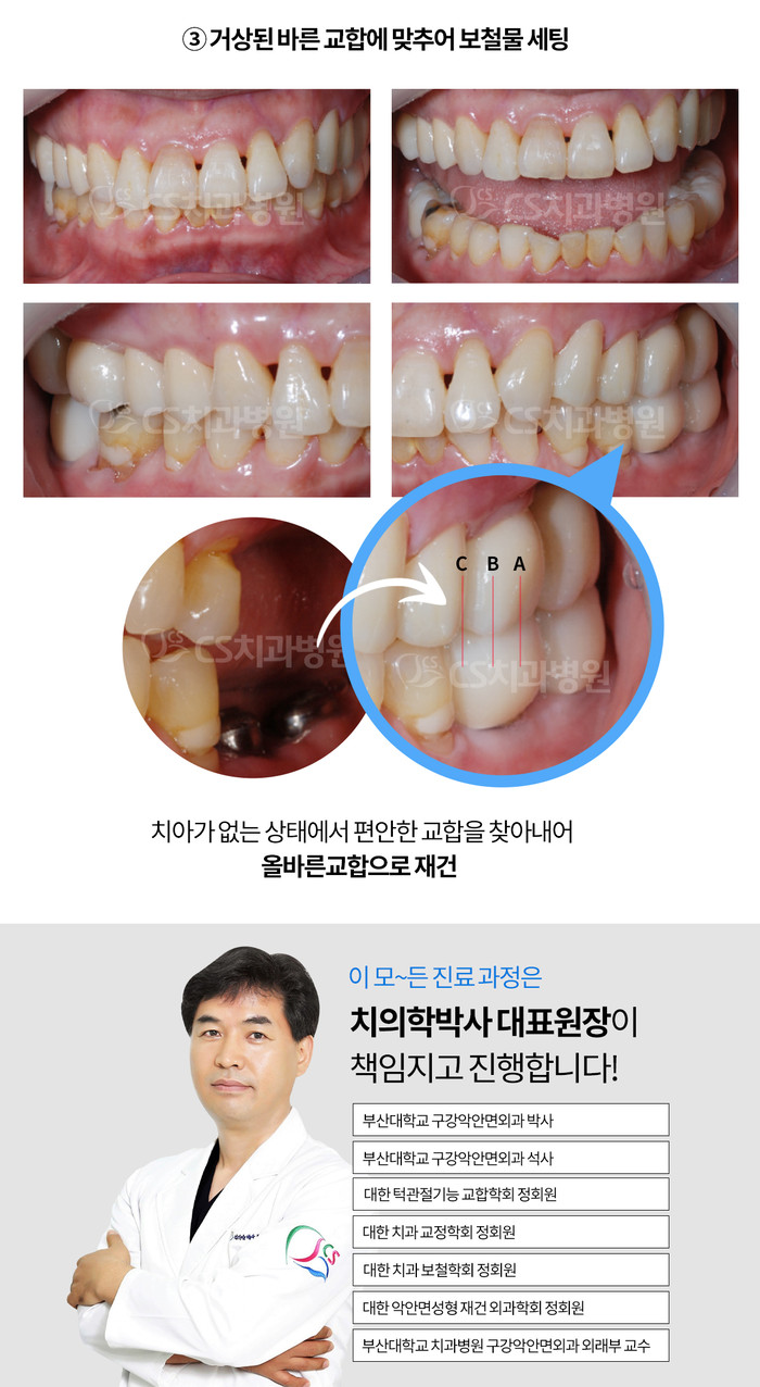 Busan jaw joint dentistry, before it gets twisted