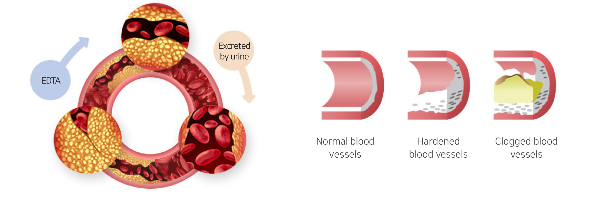 blood vessels