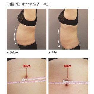 [부산] 에스테틱힐링수