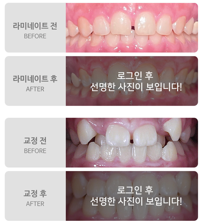 광교치과에서 치과 고민에 대한 올바른 해결책을 만나보세요