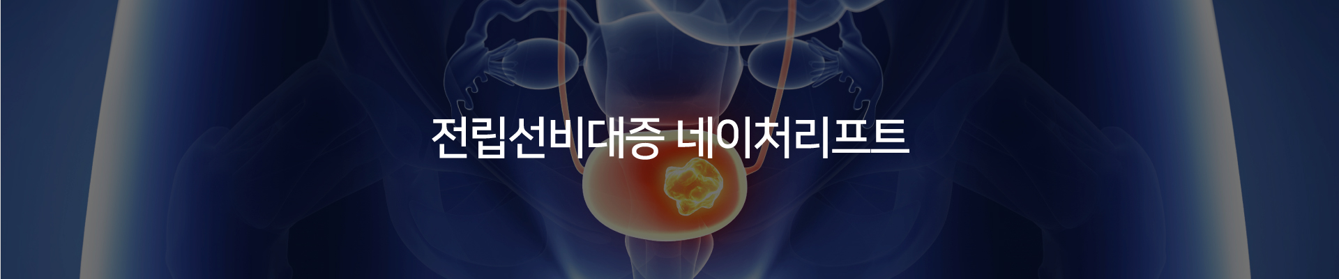 전립선비대증 네이처리프트
